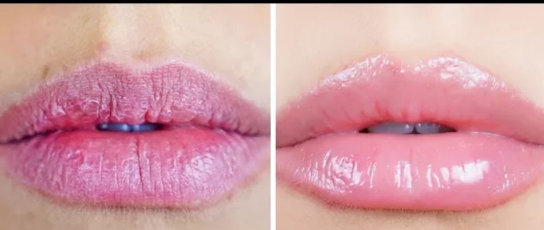 Easy way to get rid of chapped lips